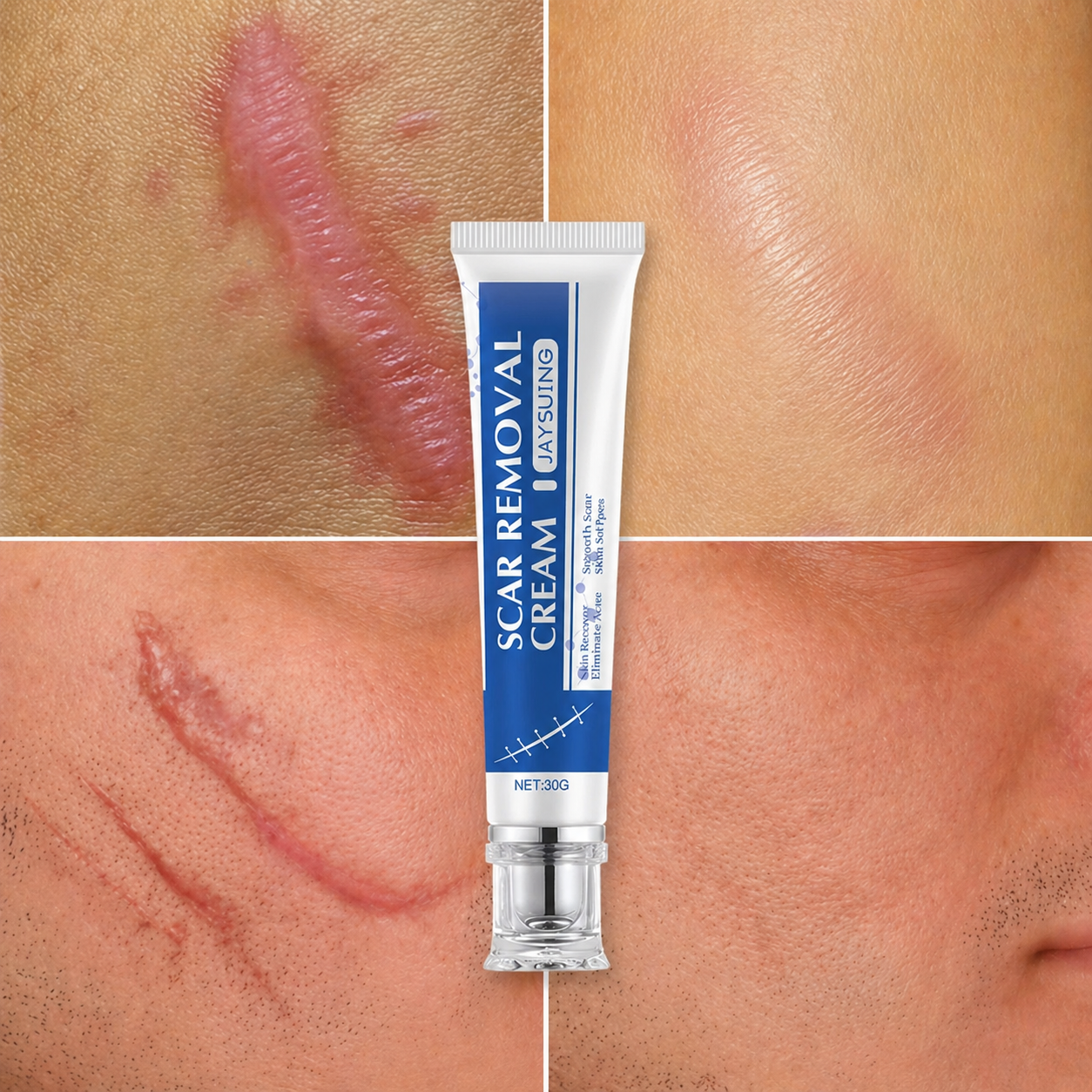 Gel Reparator Cicatrici cu Ingrediente 100% Naturale (30g)