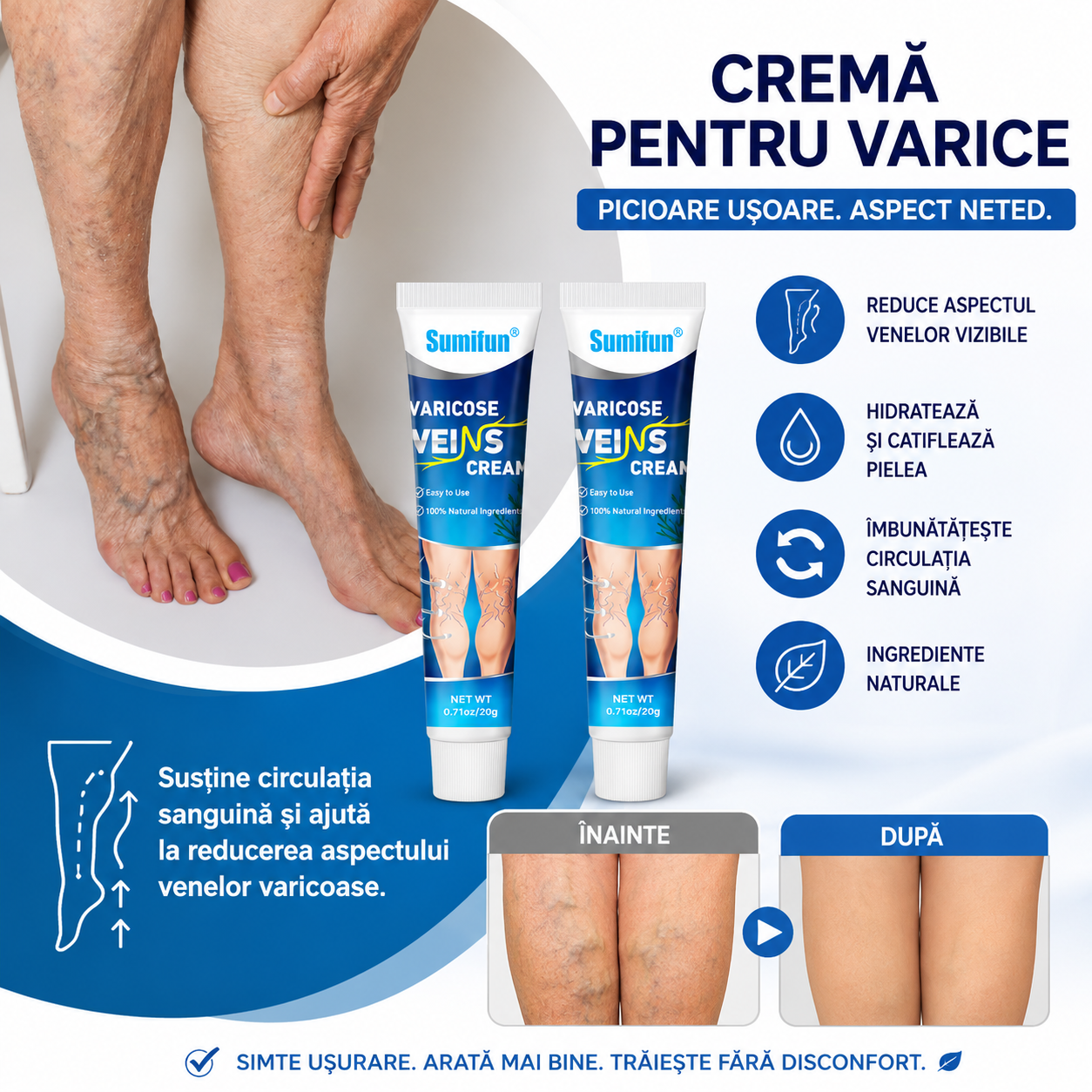 Cremă pentru Varice- Unguent pentru Ameliorarea și Îngrijirea Varicelor, 20 g
