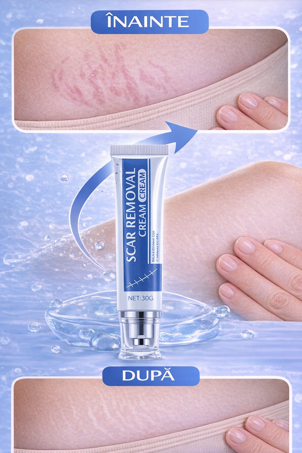 Gel Reparator Cicatrici cu Ingrediente 100% Naturale (30g)